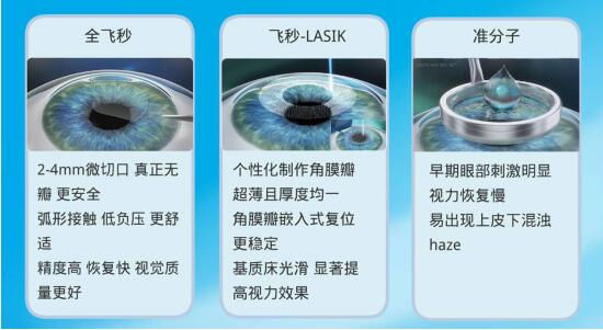 準(zhǔn)分子激光手術(shù)到底是怎么治 愈你的眼睛的？