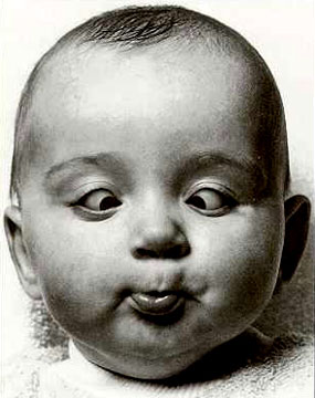 什么是斜視？斜視能嗎？