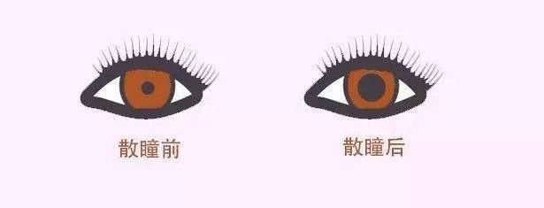 配眼鏡還散瞳，散瞳對眼睛有傷害嗎
